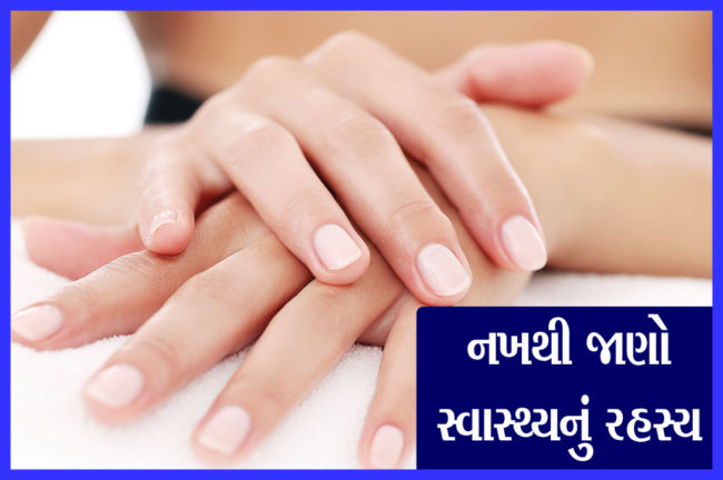 નખથી જાણો સ્વાસ્થ્યનું રહસ્ય