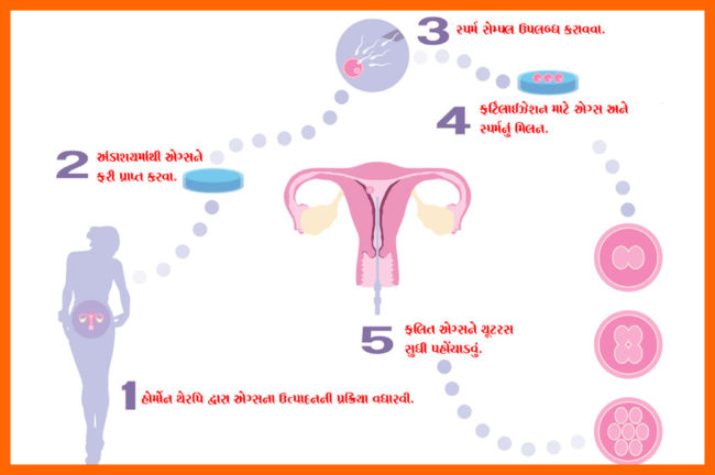 આઈવીએફ આ પણ જાણો