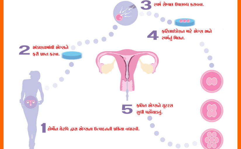 આઈવીએફ આ પણ જાણો