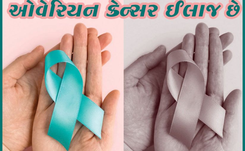 ઓવેરિયન કેન્સર ઈલાજ છે