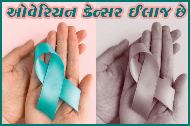 ઓવેરિયન કેન્સર ઈલાજ છે